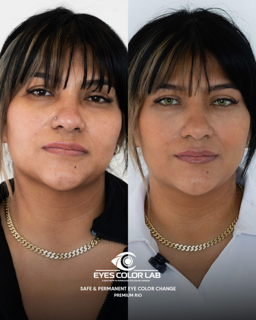 ecl-before-after (23)