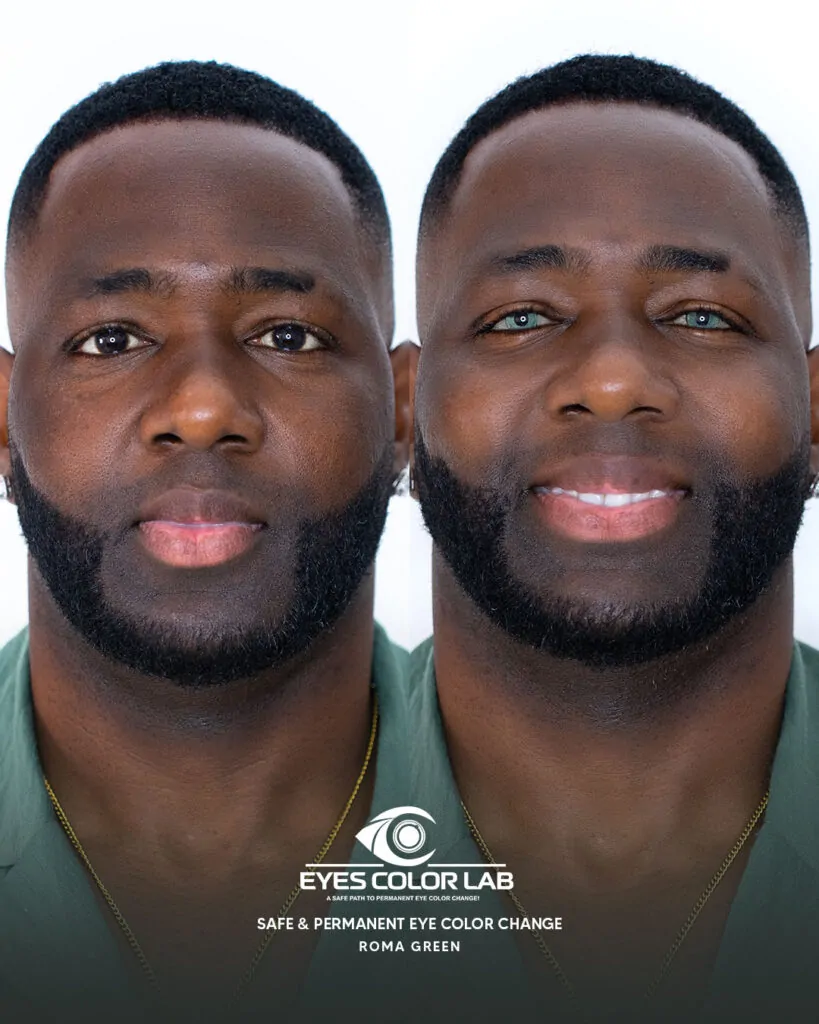 ecl-before-after (11)