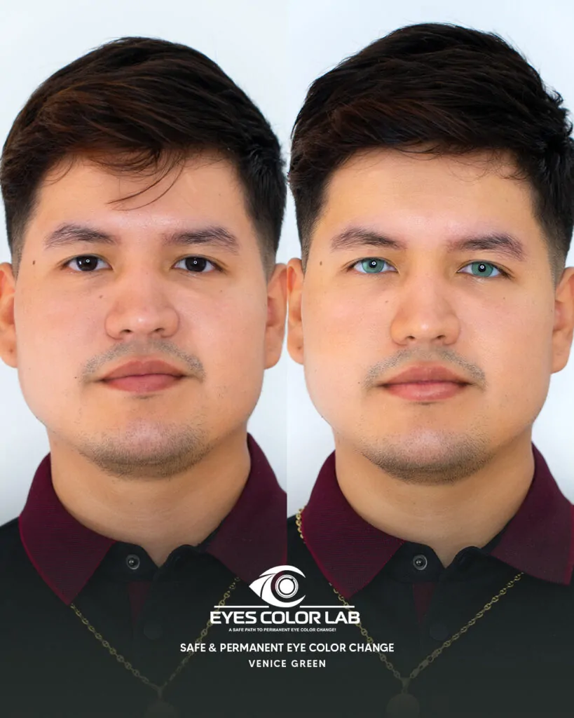 ecl-before-after (2)