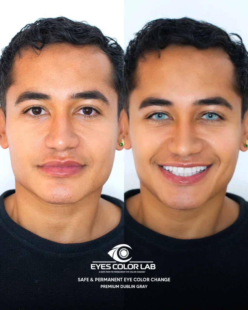 ecl-before-after (21)