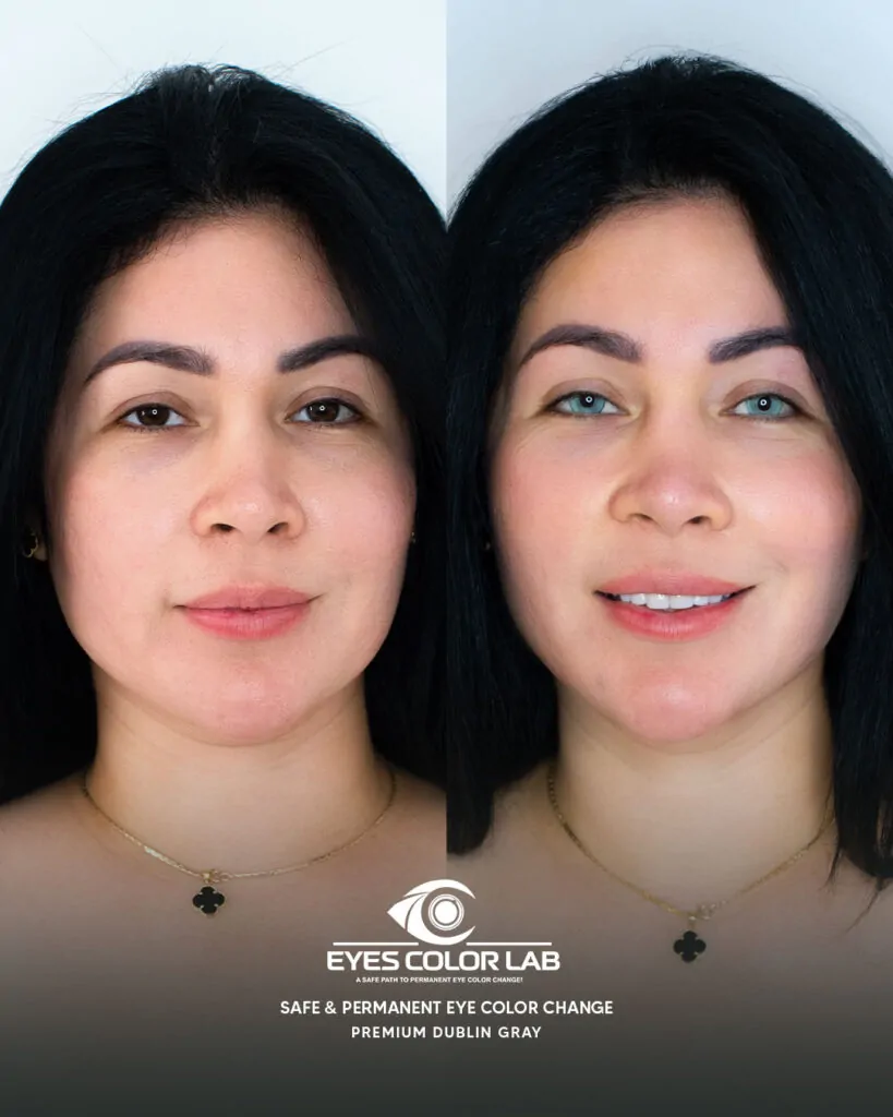 ecl-before-after (30)