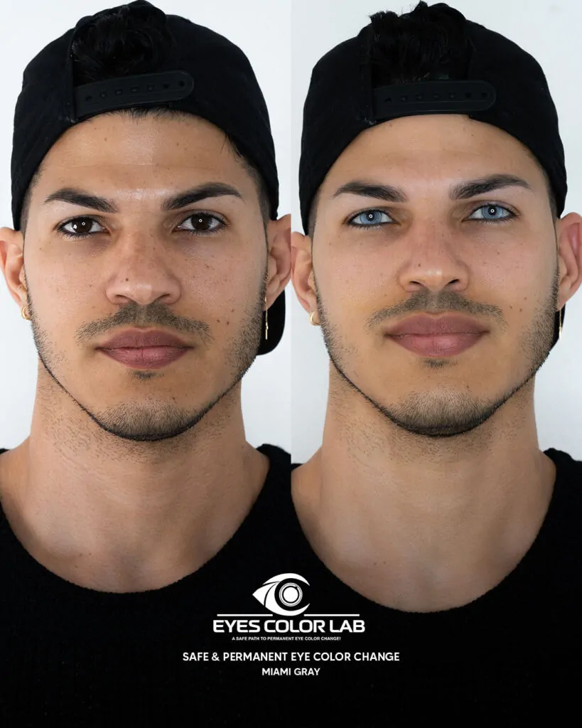 ecl-before-after (31)