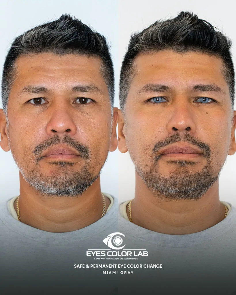 ecl-before-after (4)